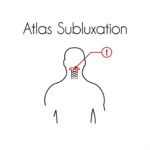 Subluxation