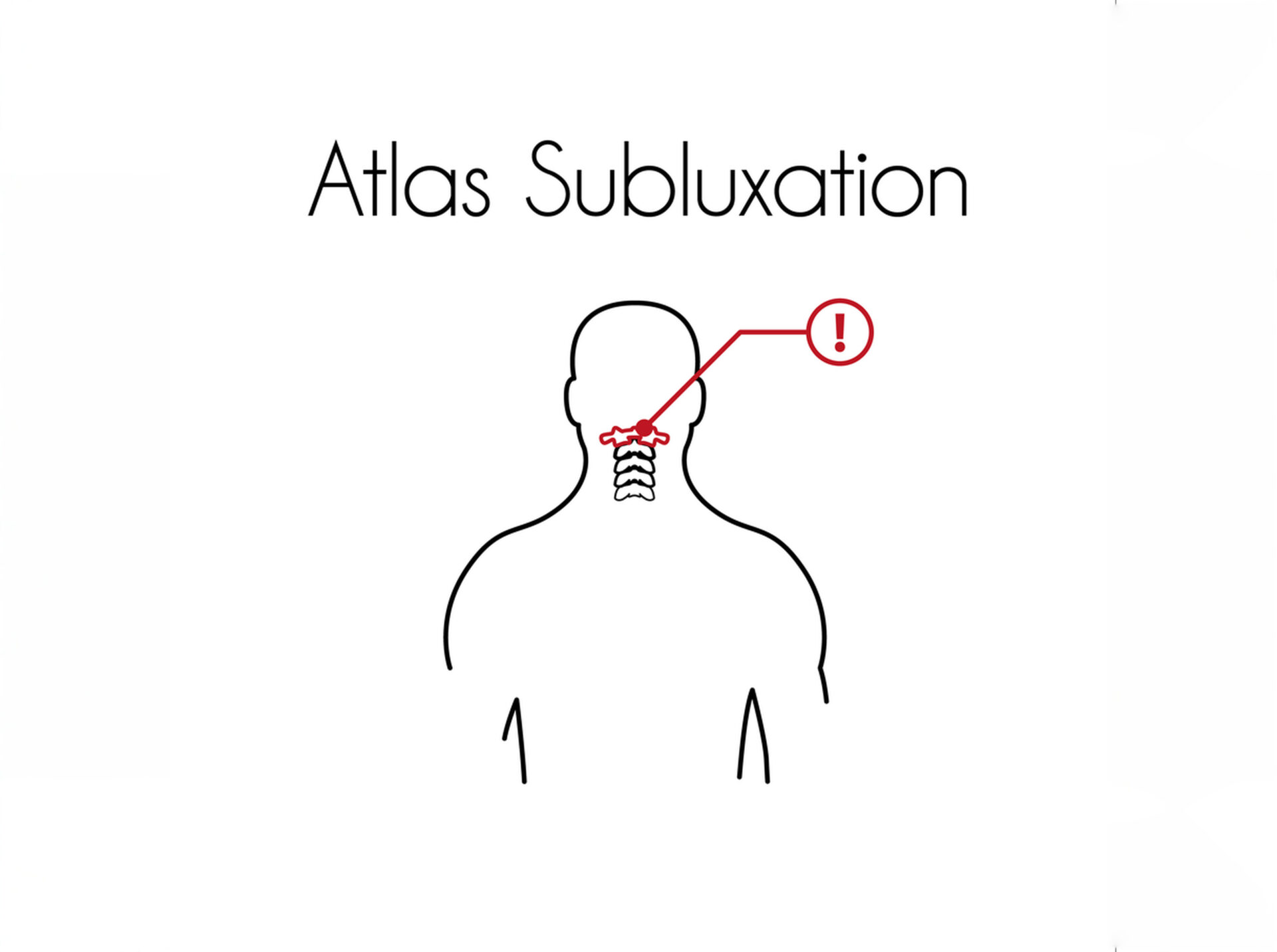 Subluxation