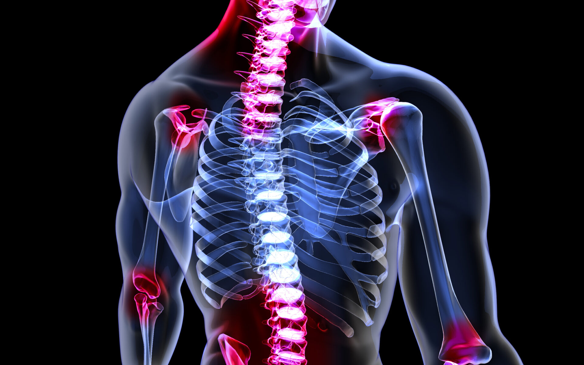 How Joint Restrictions Develop in the Spine